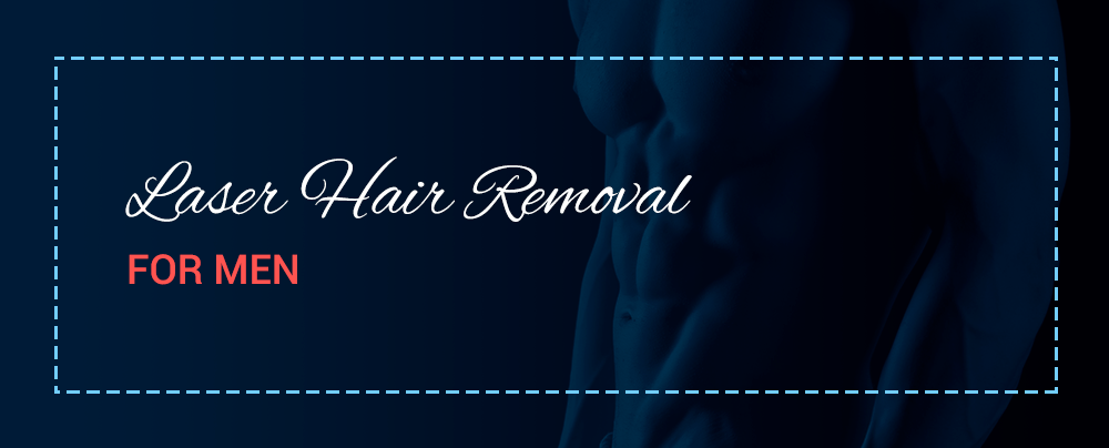 laser hair removal for men