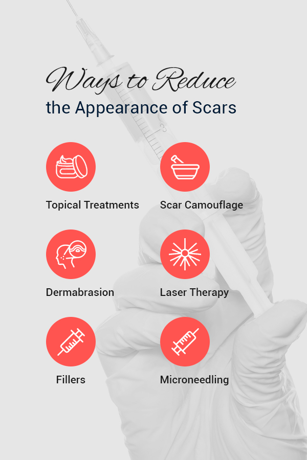 Ways to reduce the appearance of scars