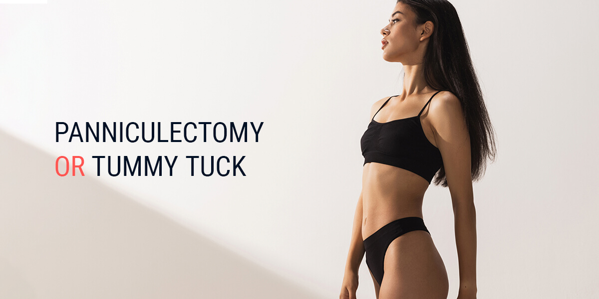 Panniculectomy or Tummy Tuck