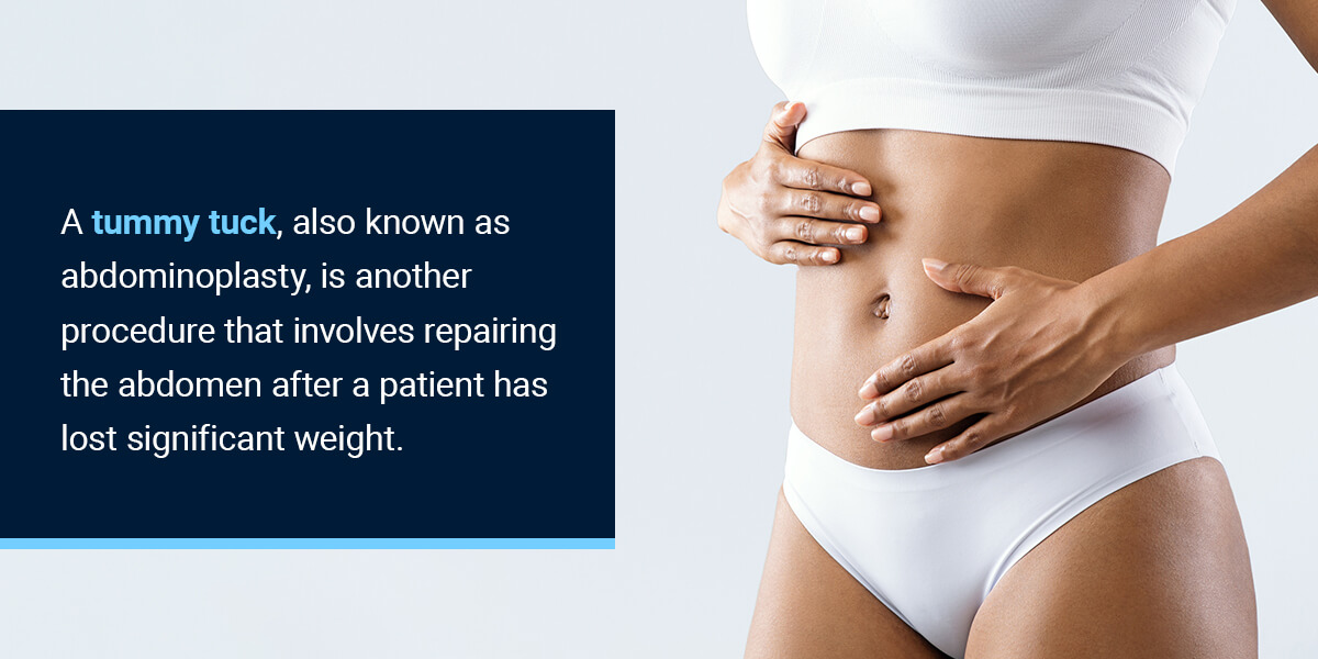 What Is a Tummy Tuck?