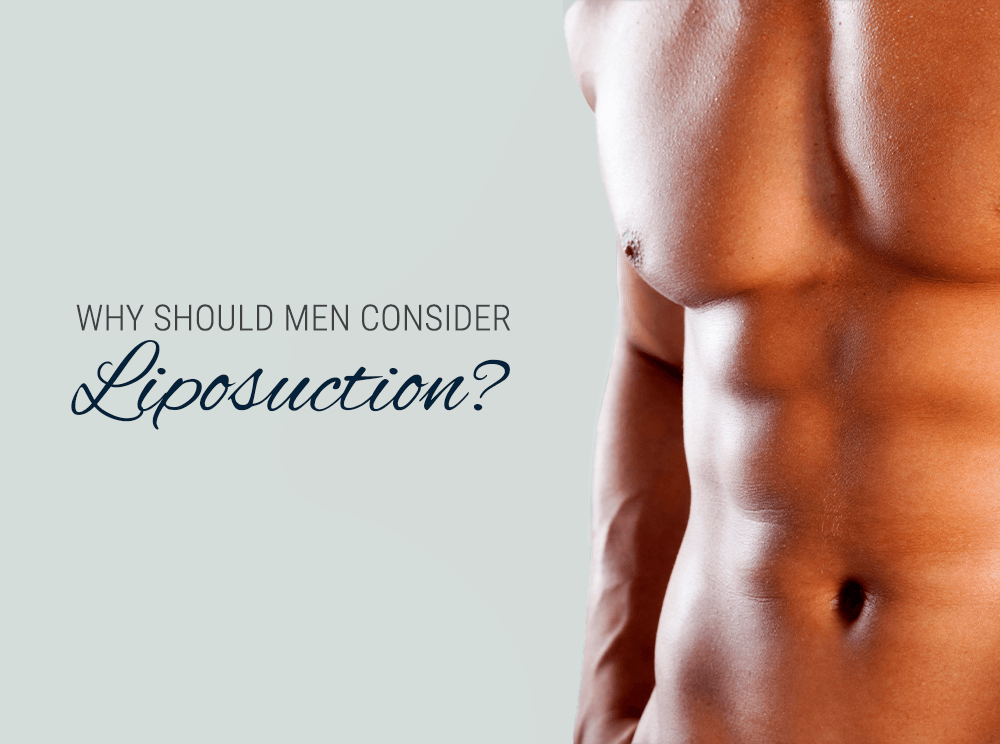 Why Should Men Consider Liposuction?