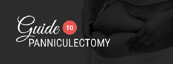 guia para panniculectomy cirurgia