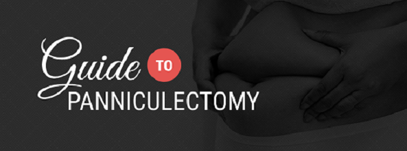 guide till panniculectomy kirurgi