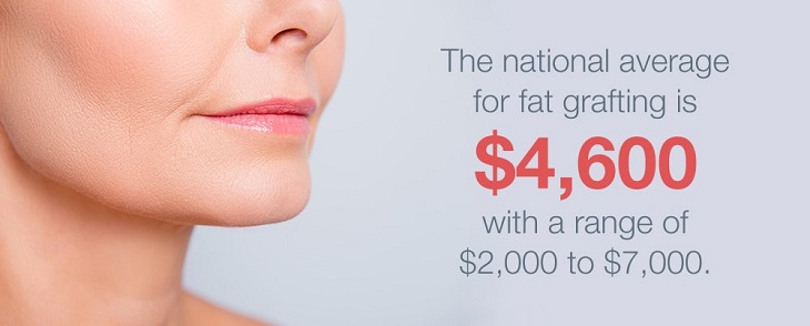 fat transfer costs