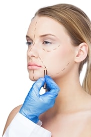 facelift surgery